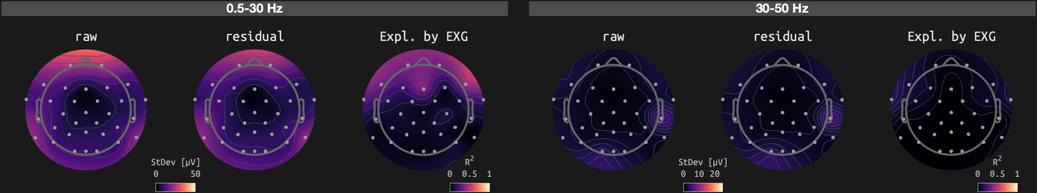 figs/sub-02_ses-15_run-11.png