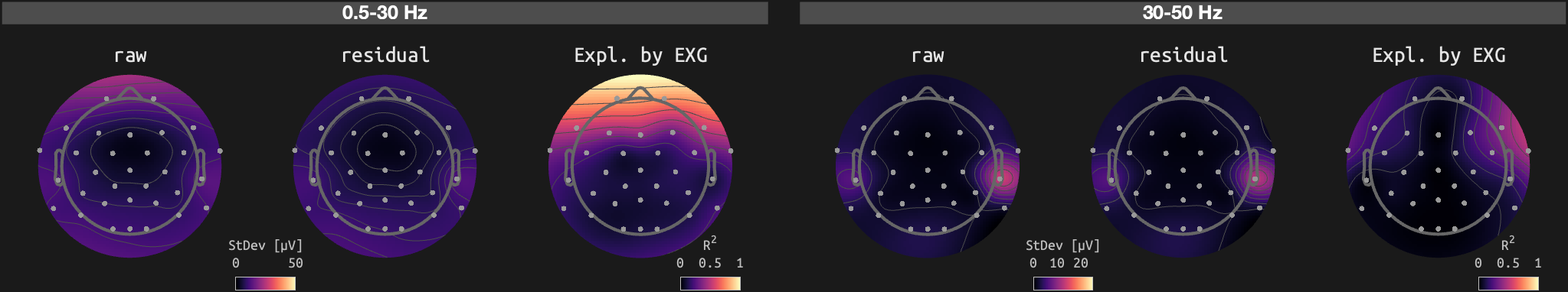 figs/sub-02_ses-15_run-12.png