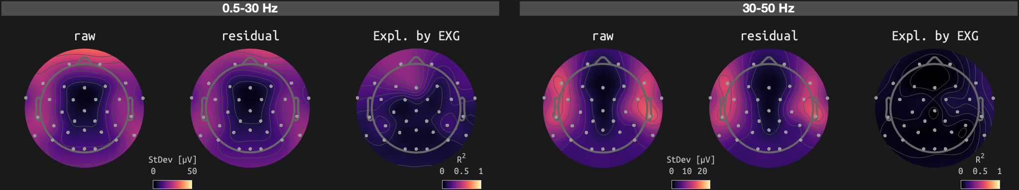figs/sub-02_ses-15_run-13.png