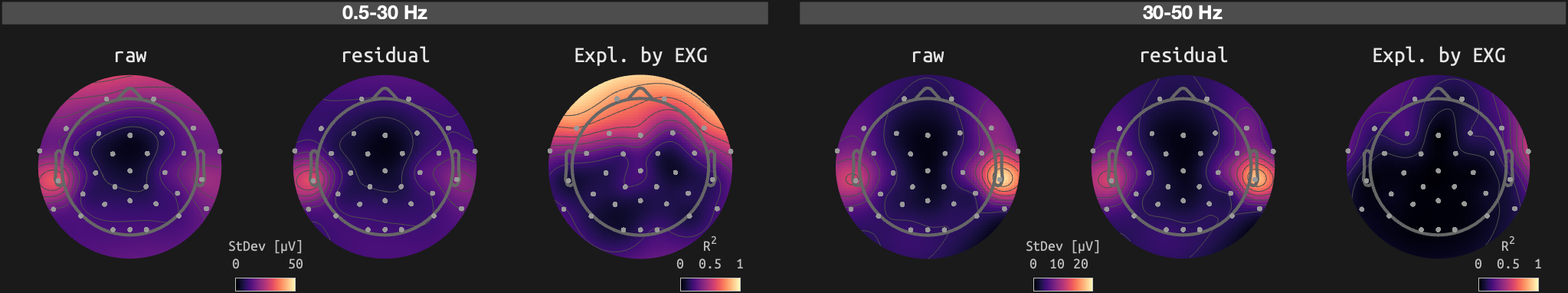 figs/sub-02_ses-15_run-14.png