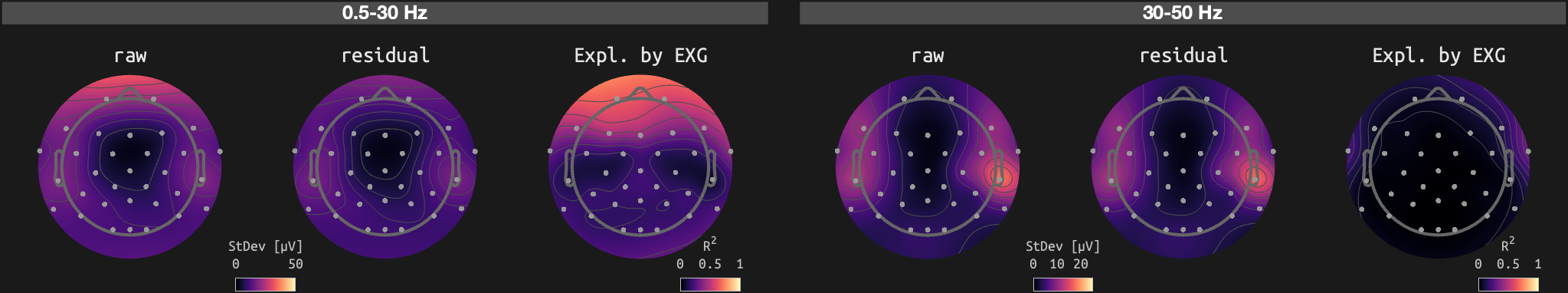 figs/sub-02_ses-15_run-15.png
