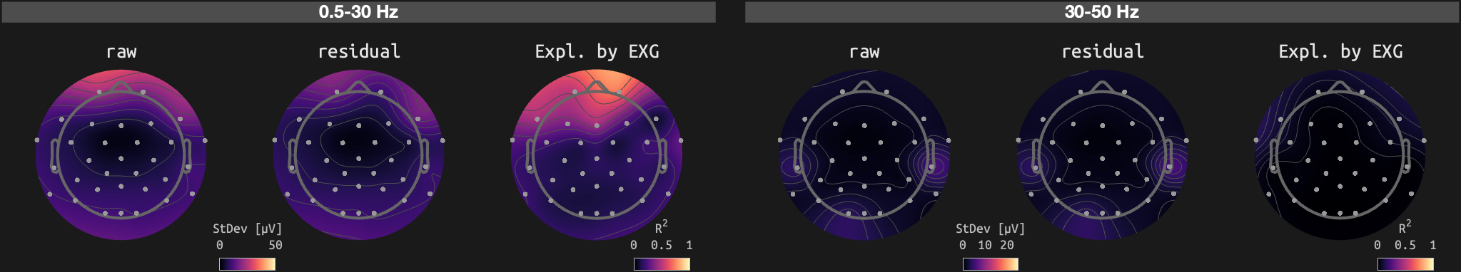 figs/sub-02_ses-16_run-01.png