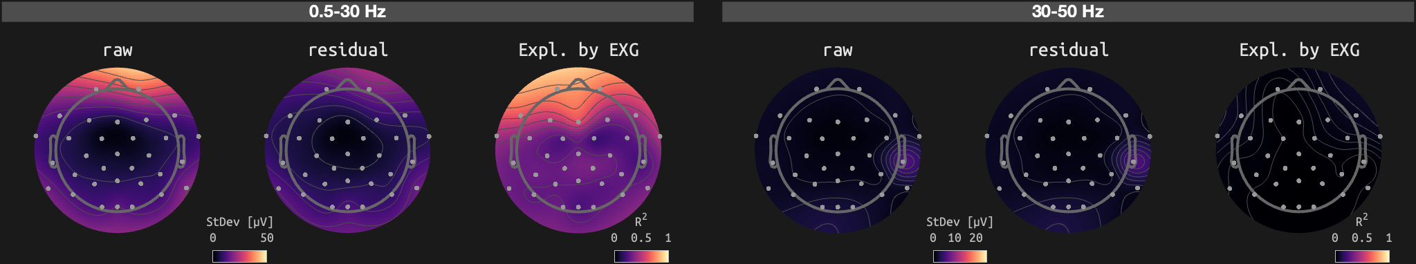 figs/sub-02_ses-16_run-02.png