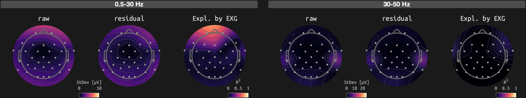 figs/sub-02_ses-16_run-03.png