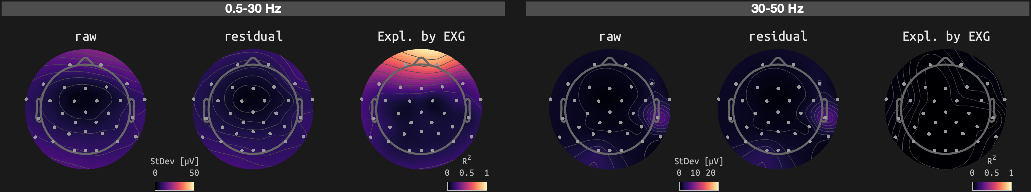 figs/sub-02_ses-16_run-04.png