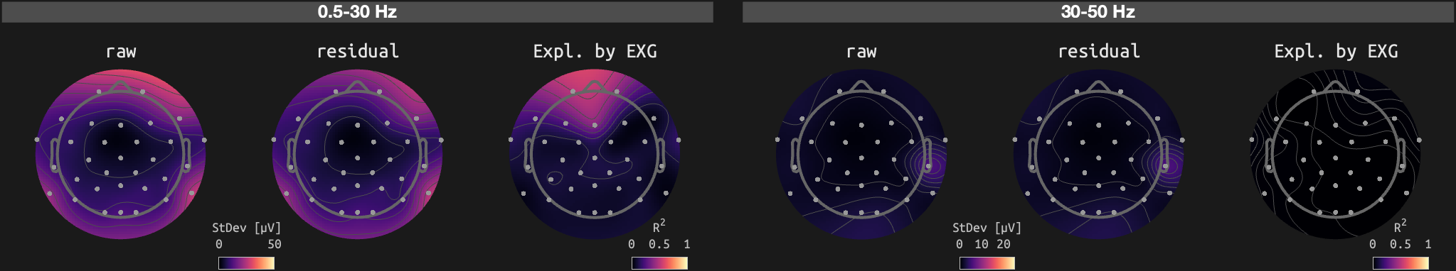 figs/sub-02_ses-16_run-05.png