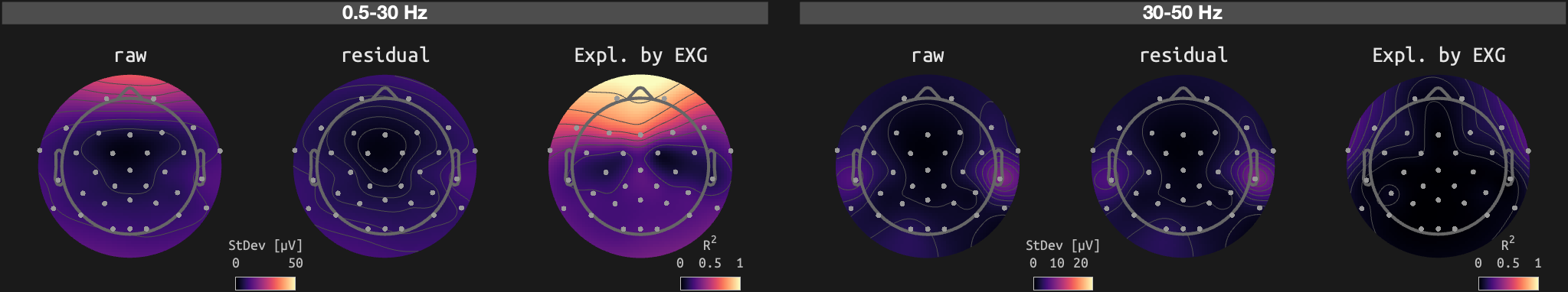 figs/sub-02_ses-16_run-12.png