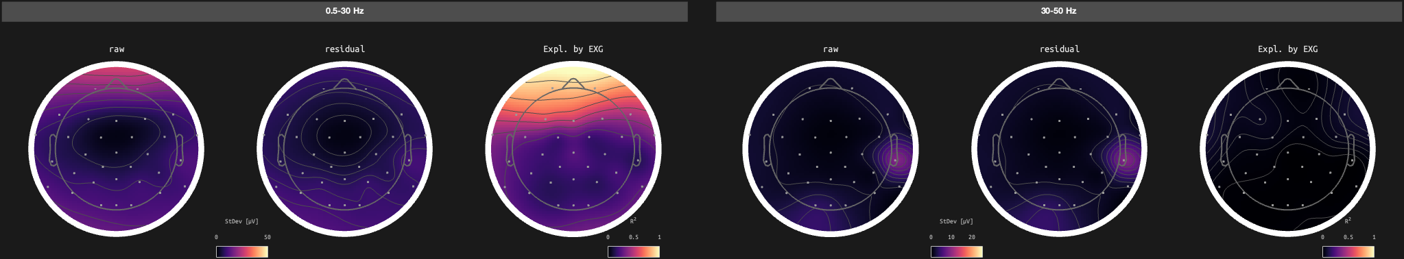 figs/sub-02_ses-17_run-01.png