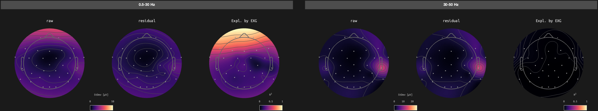 figs/sub-02_ses-17_run-02.png