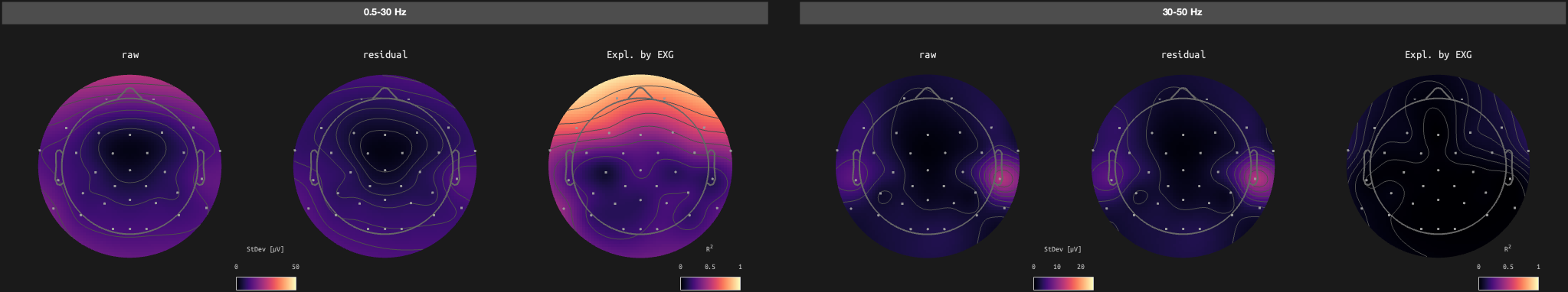 figs/sub-02_ses-17_run-03.png