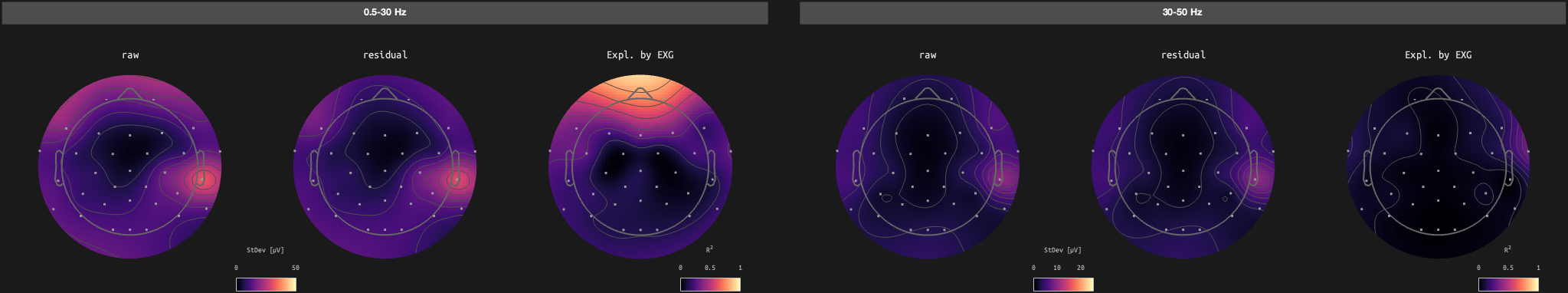 figs/sub-02_ses-17_run-05.png