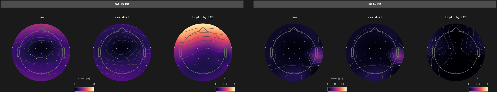 figs/sub-02_ses-17_run-08.png