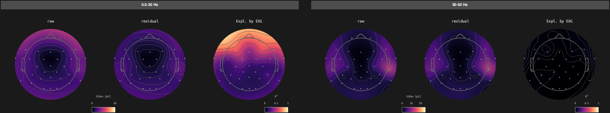 figs/sub-02_ses-17_run-11.png
