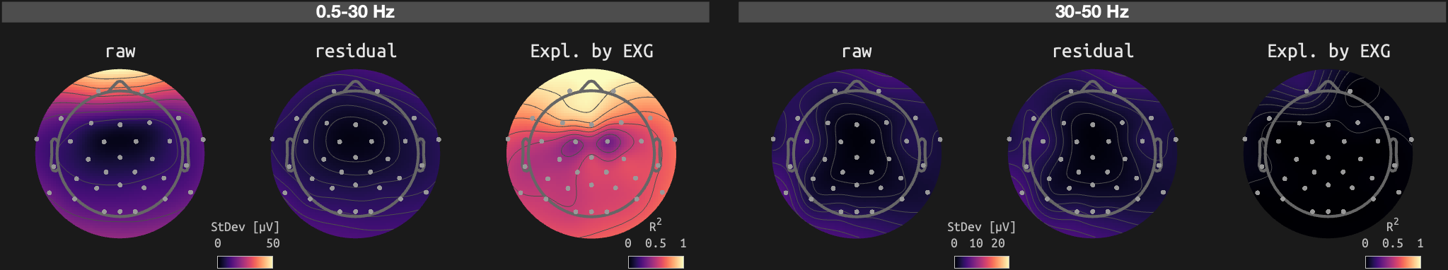 figs/sub-07_ses-15_run-11.png