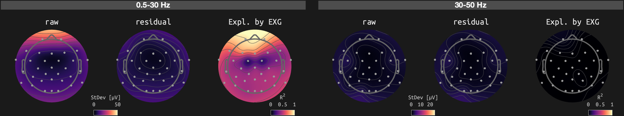 figs/sub-07_ses-16_run-02.png