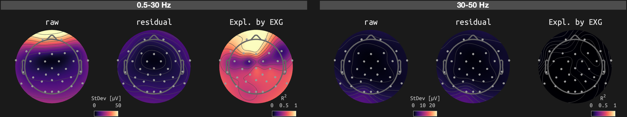 figs/sub-07_ses-16_run-11.png