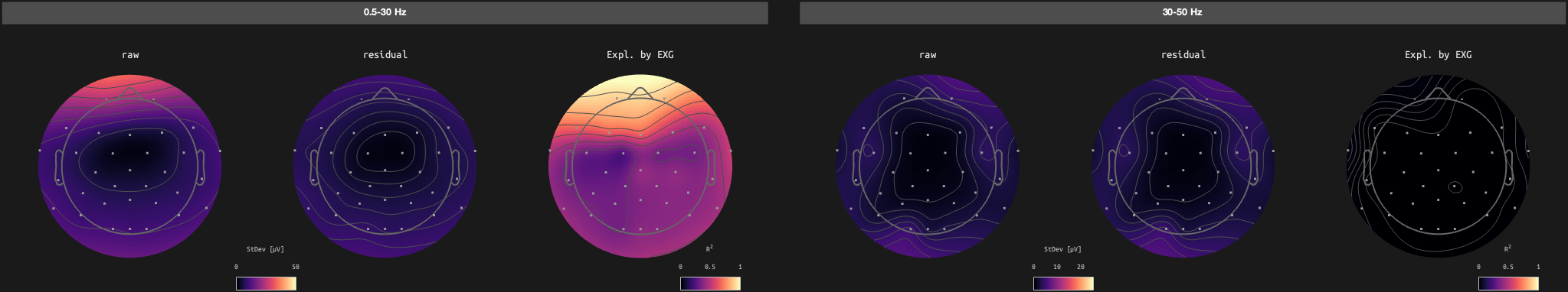 figs/sub-07_ses-17_run-01.png