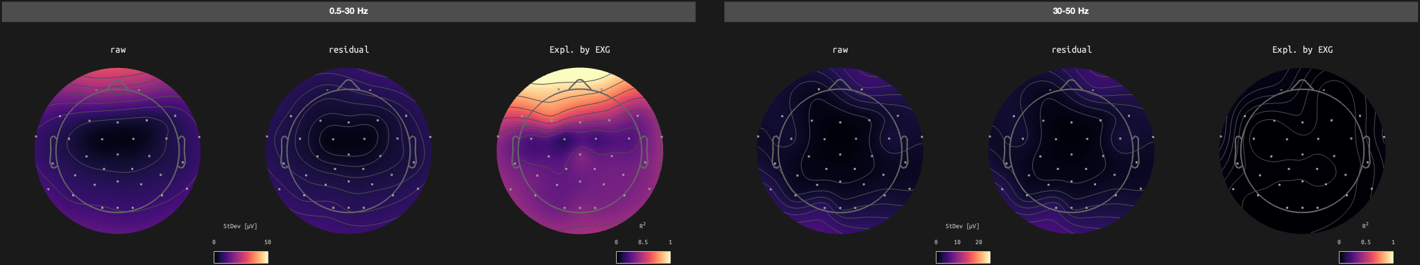 figs/sub-07_ses-17_run-05.png