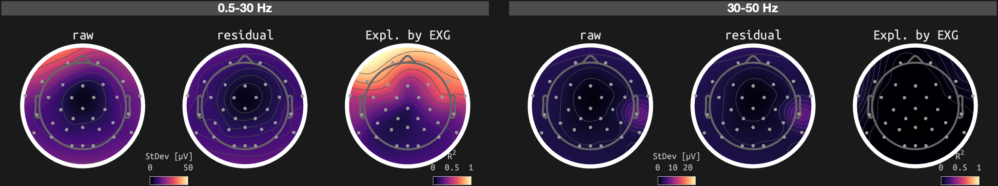 figs/sub-10_ses-16_run-01.png