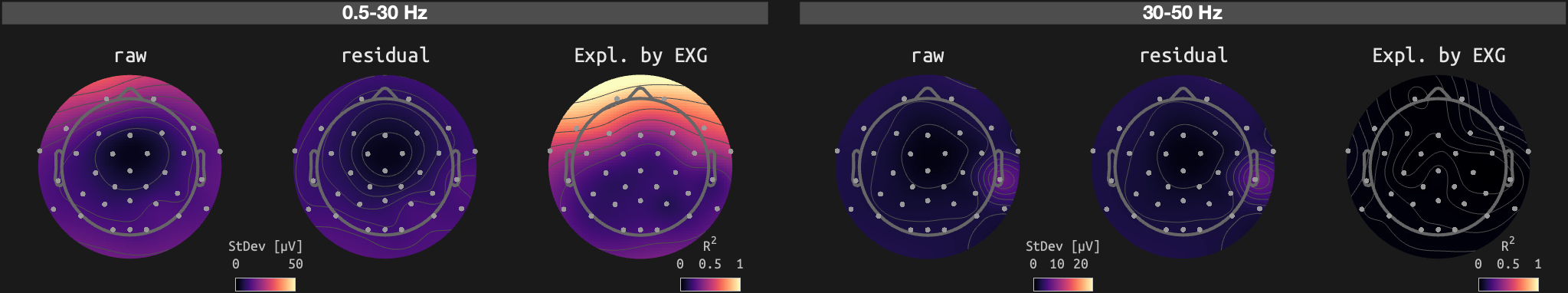 figs/sub-10_ses-16_run-02.png