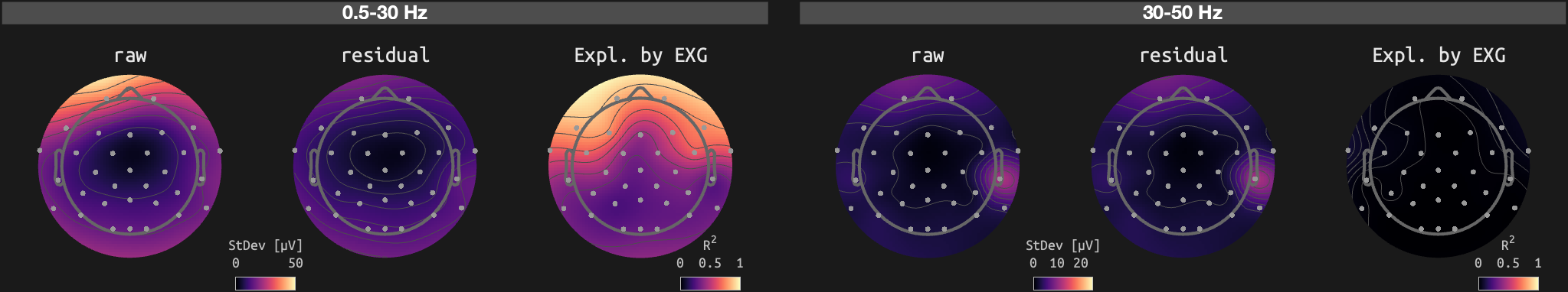 figs/sub-10_ses-16_run-05.png