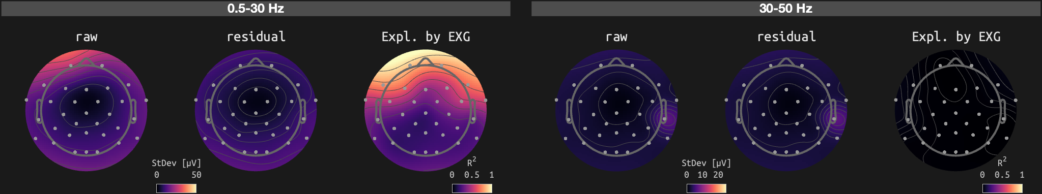 figs/sub-10_ses-16_run-10.png
