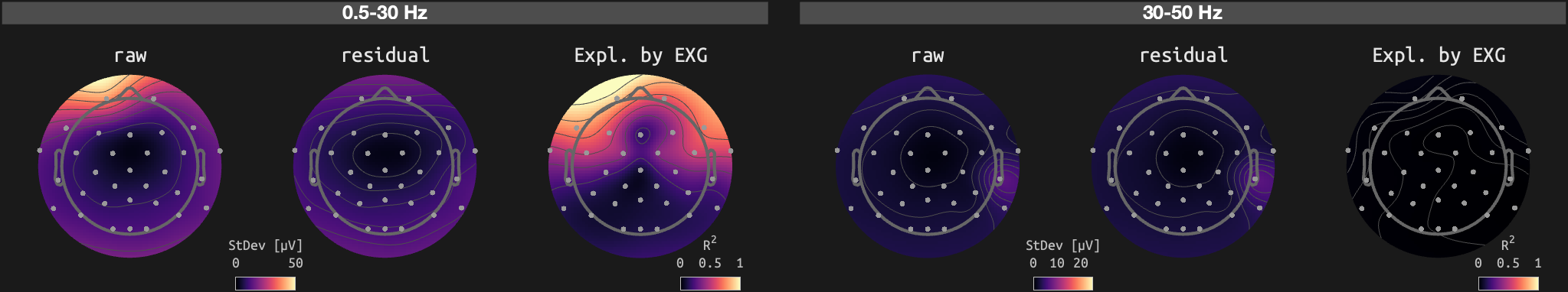 figs/sub-10_ses-16_run-11.png