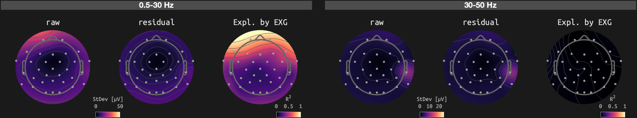 figs/sub-10_ses-16_run-12.png