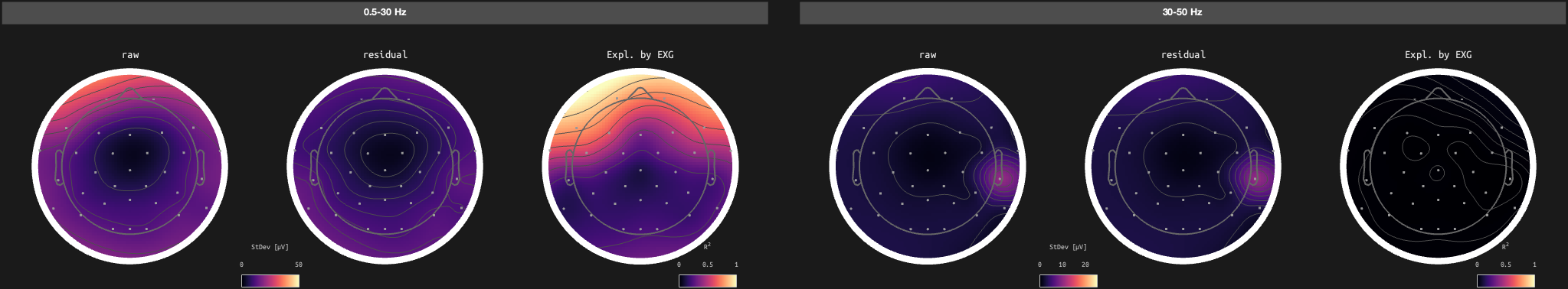figs/sub-10_ses-17_run-01.png