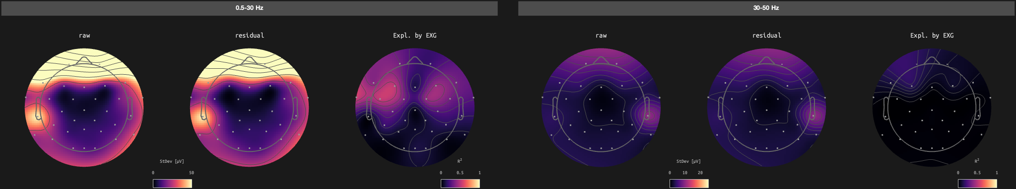 figs/sub-10_ses-17_run-02.png