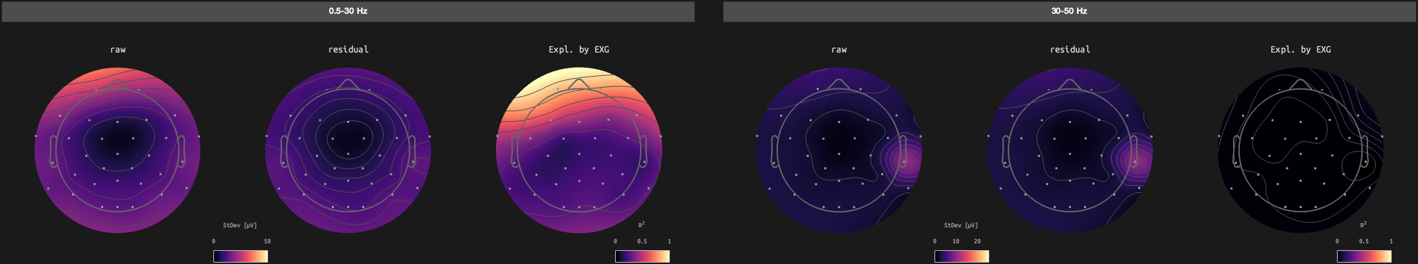 figs/sub-10_ses-17_run-03.png