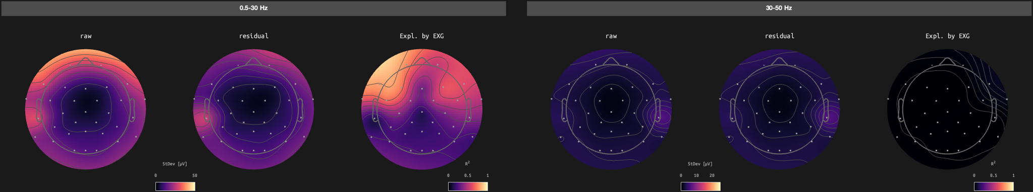 figs/sub-10_ses-17_run-04.png