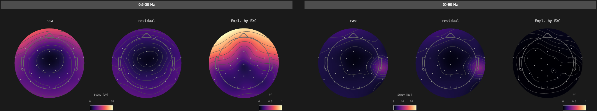 figs/sub-10_ses-17_run-05.png