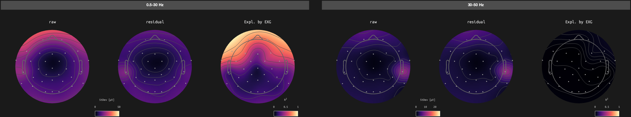 figs/sub-10_ses-17_run-06.png