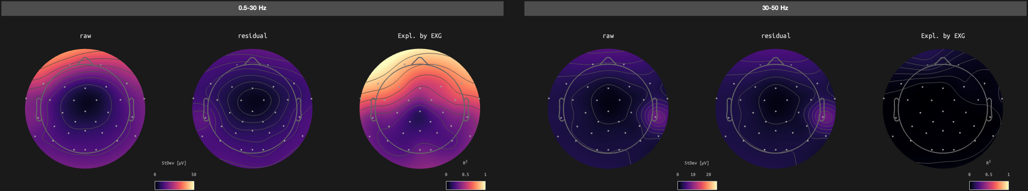 figs/sub-10_ses-17_run-07.png