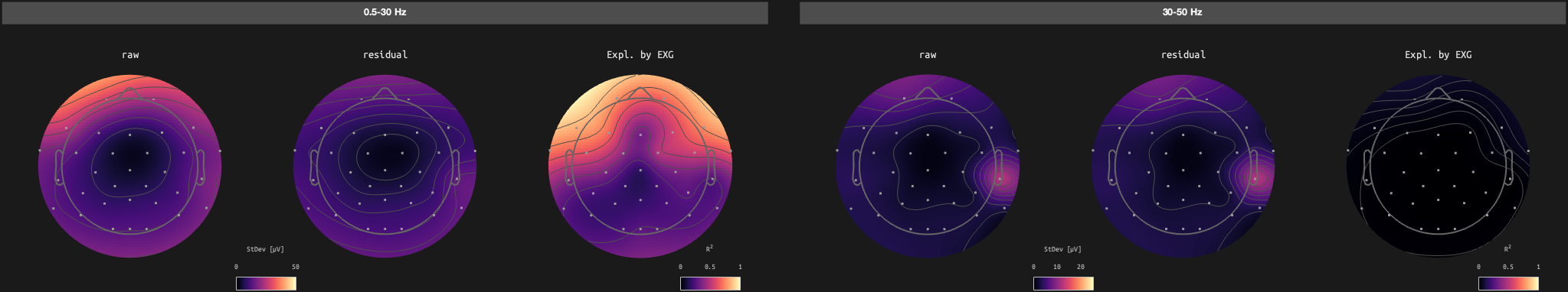 figs/sub-10_ses-17_run-10.png
