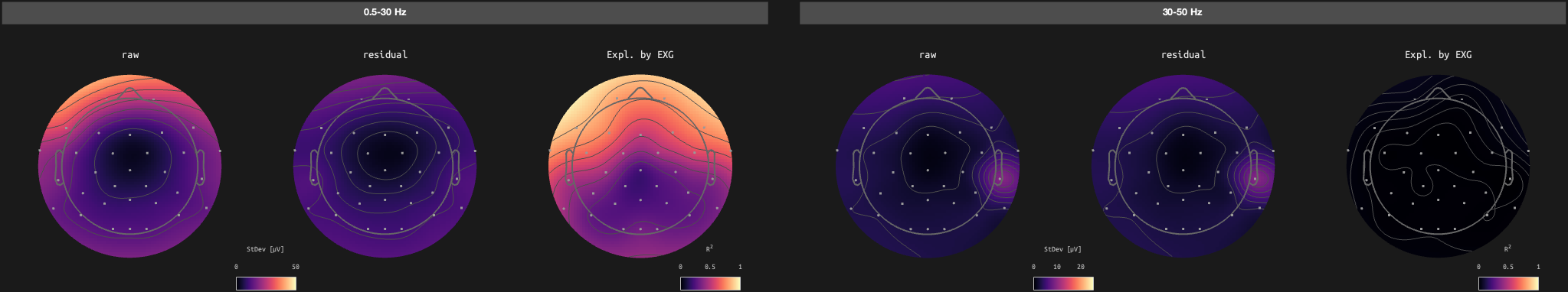 figs/sub-10_ses-17_run-11.png