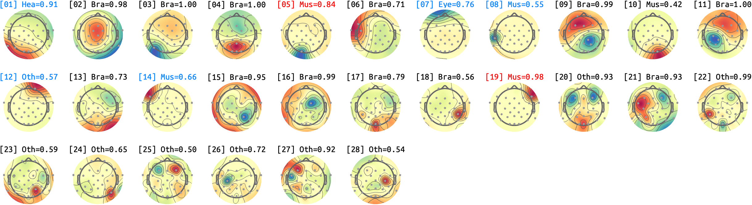 figs/sub-02_ses-15_run-04.png