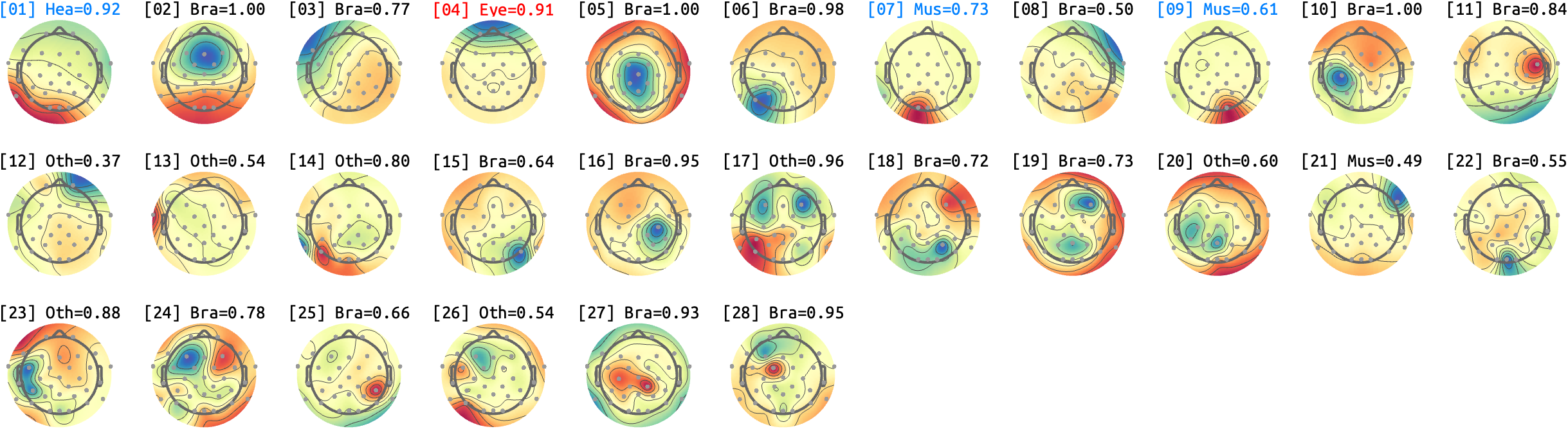 figs/sub-02_ses-15_run-12.png