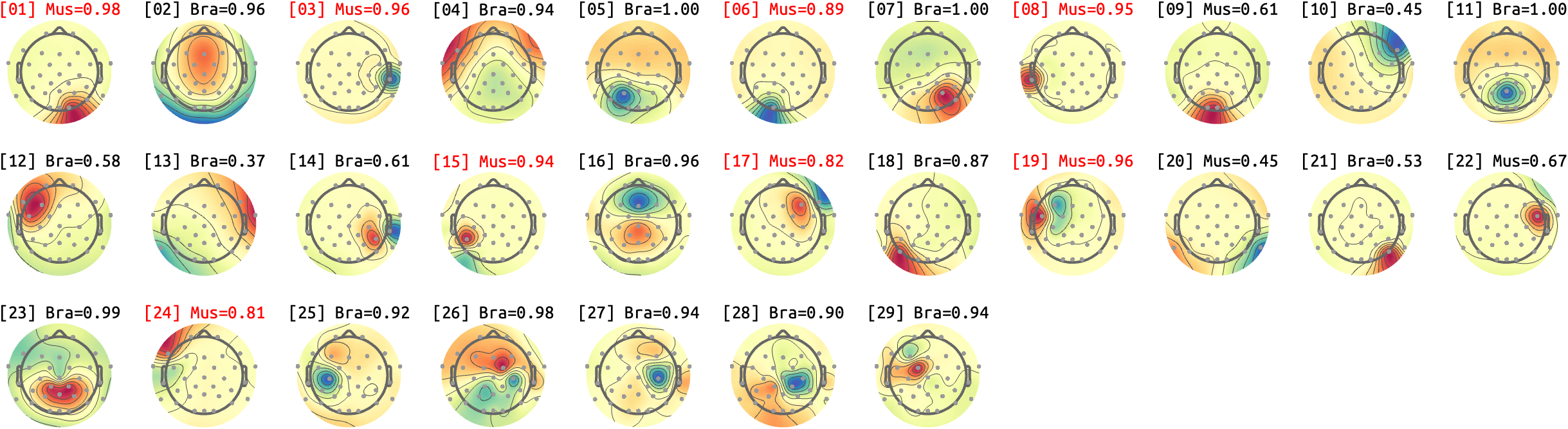 figs/sub-09_ses-15_run-10.png