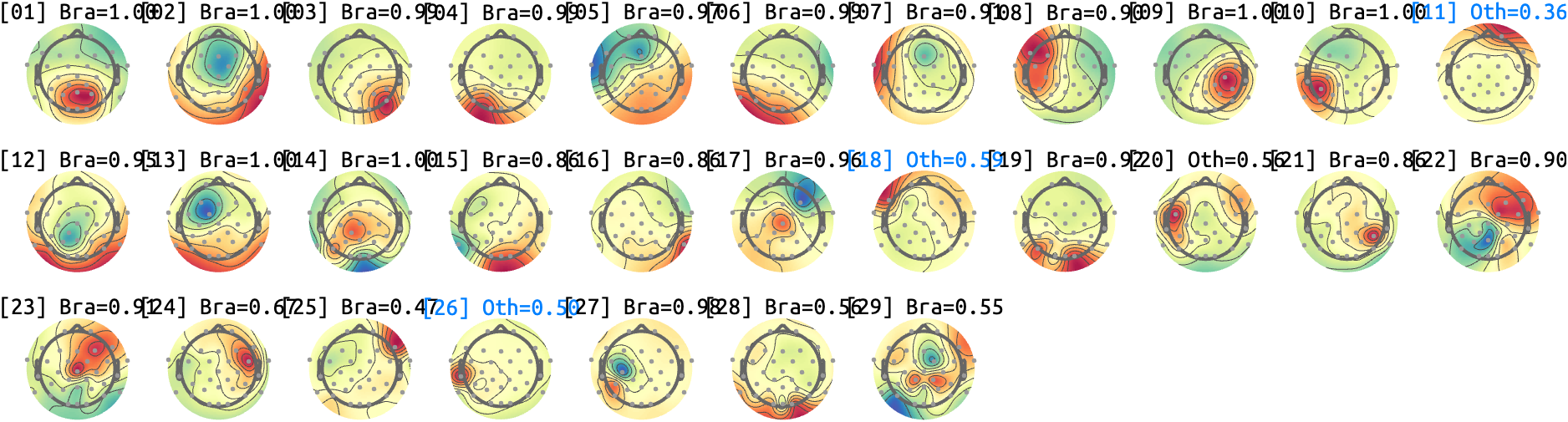 figs/sub-10_ses-17_run-05.png