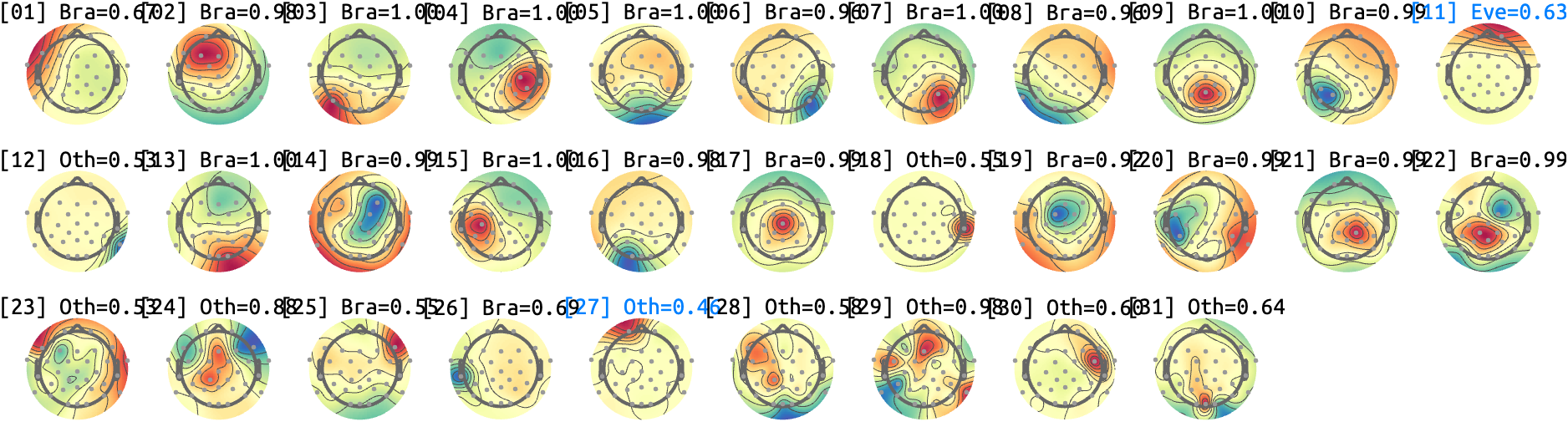 figs/sub-10_ses-17_run-09.png