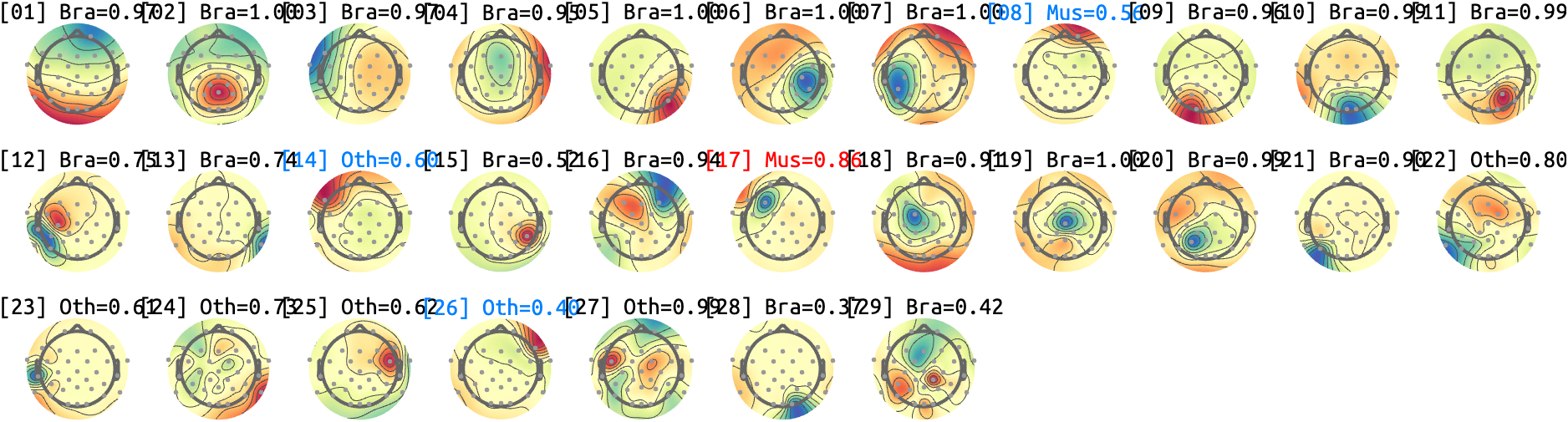 figs/sub-10_ses-17_run-10.png