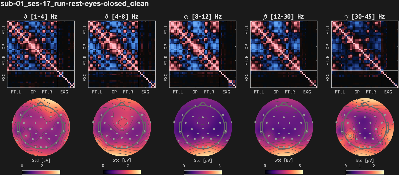 figs/cov-sub-01_ses17_run-rest-eyes-closed_clean.png