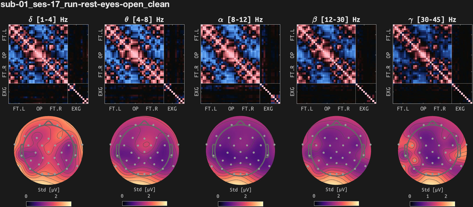 figs/cov-sub-01_ses17_run-rest-eyes-open_clean.png