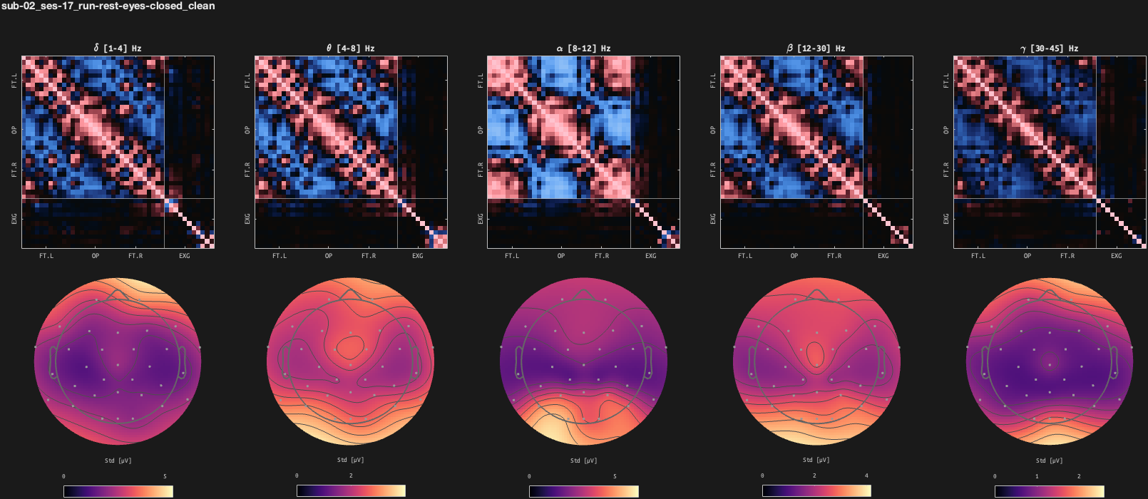 figs/cov-sub-02_ses17_run-rest-eyes-closed_clean.png