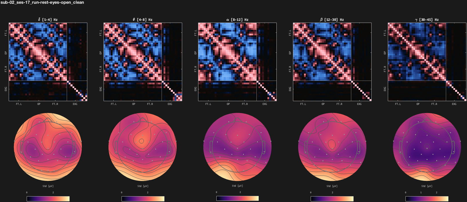 figs/cov-sub-02_ses17_run-rest-eyes-open_clean.png