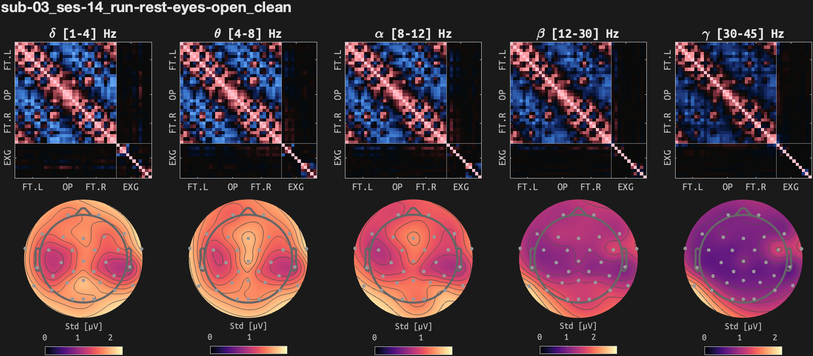 figs/cov-sub-03_ses14_run-rest-eyes-open_clean.png