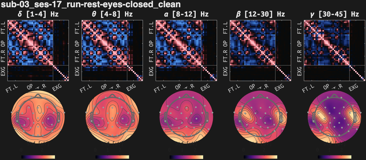 figs/cov-sub-03_ses17_run-rest-eyes-closed_clean.png