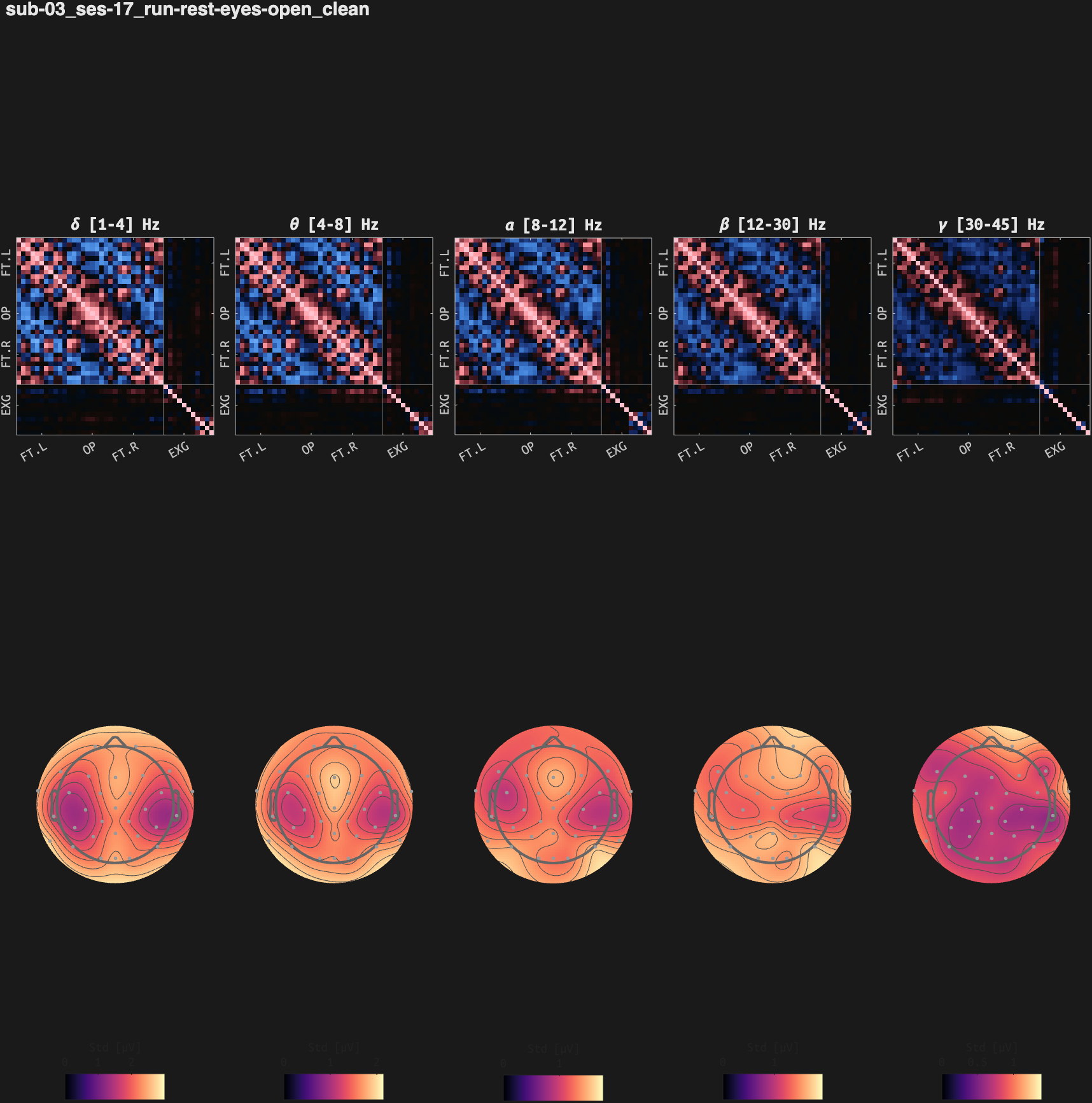 figs/cov-sub-03_ses17_run-rest-eyes-open_clean.png